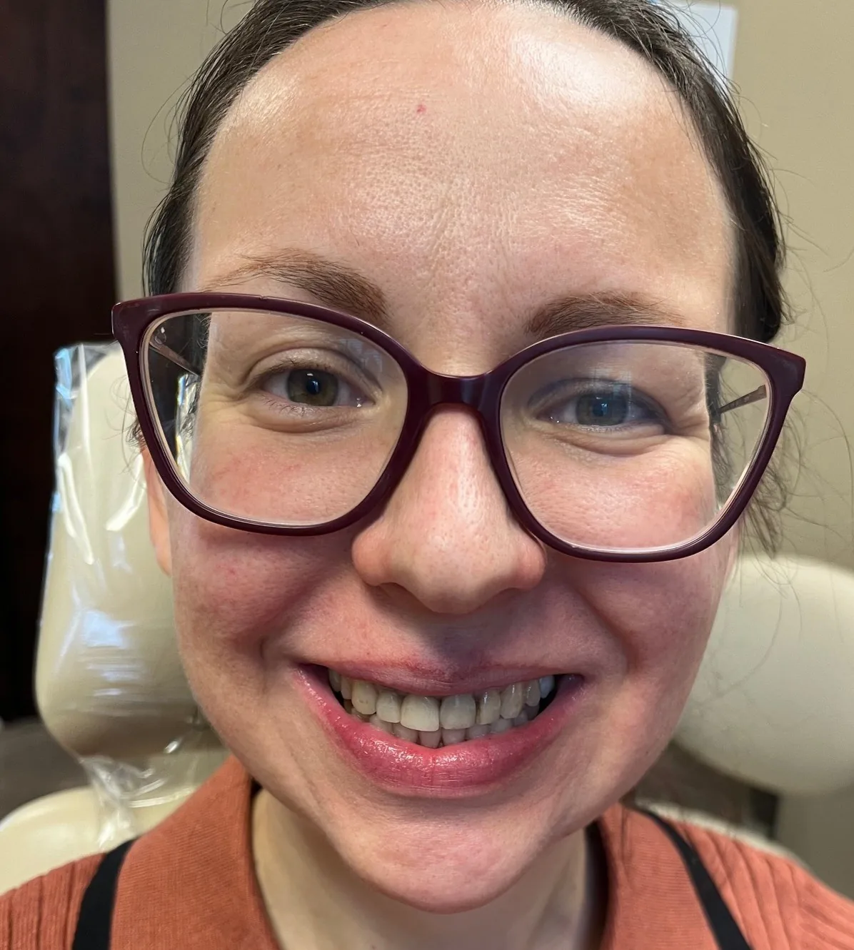 Denture result