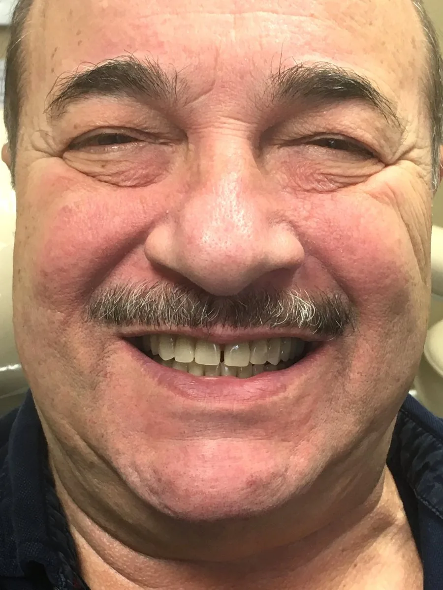 Happy patient with new denture
